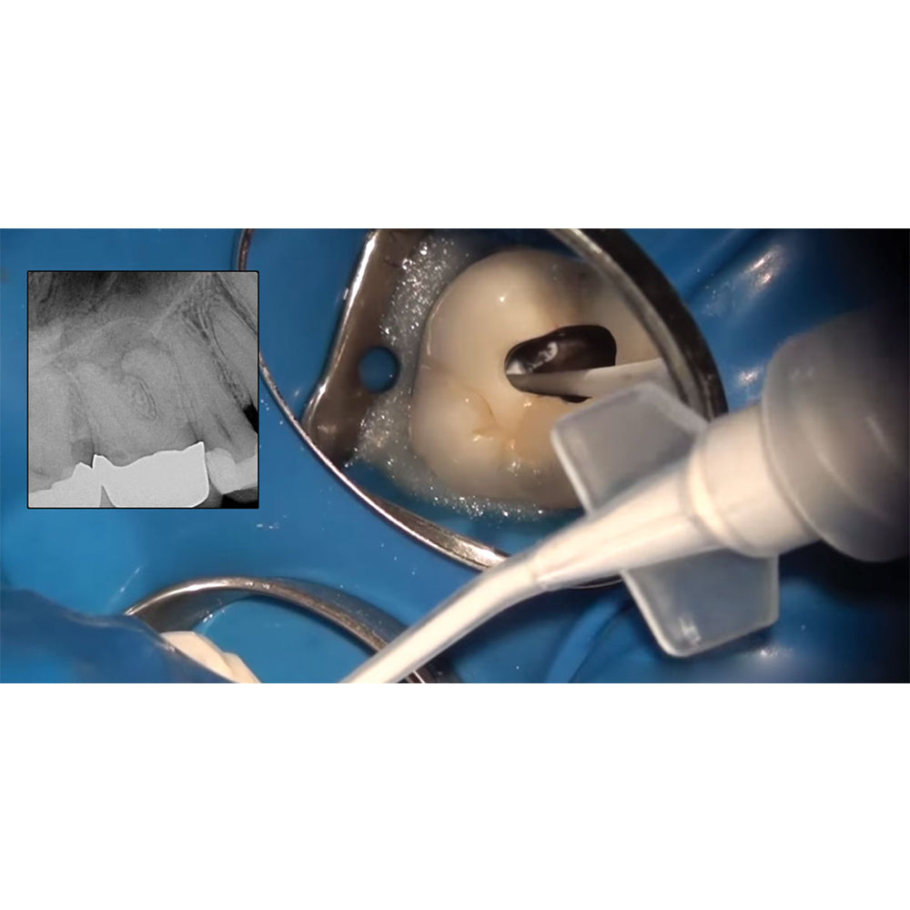 Meta CeraSeal RC Sealer