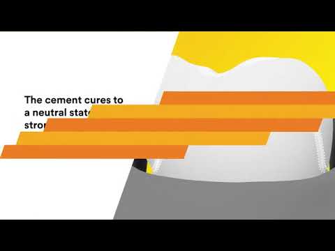 3M ESPE RelyX U200 Self-Adhesive Resin Cement
