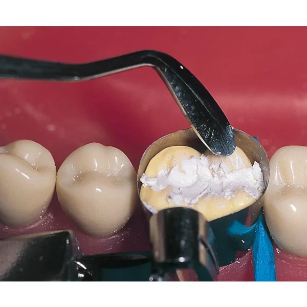 Ammdent Cavitemp Temporary Filling Cement - Image 3