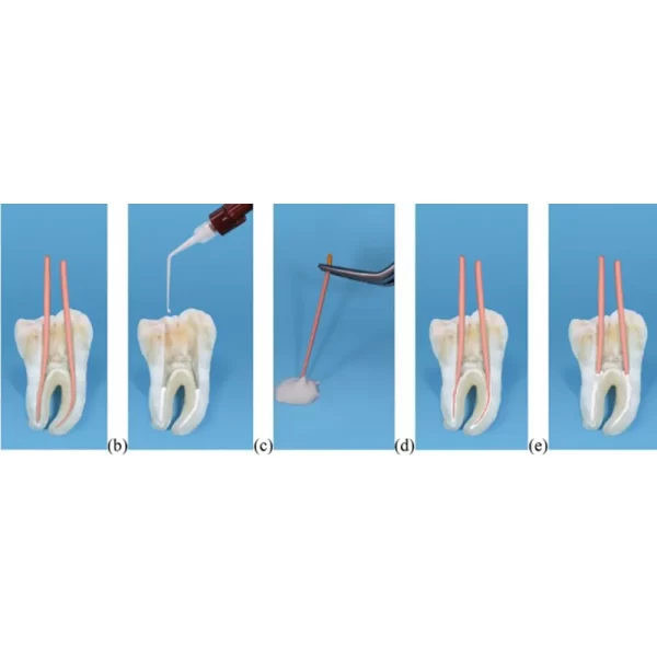 Meta CeraSeal RC Sealer - Image 3