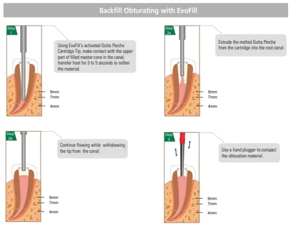 Diadent EvoFill Gutta Percha Cartridges - Image 5